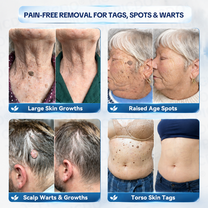 𝐏𝐡𝐚𝐫𝐦𝐚𝐜𝐢𝐬𝐭 𝐑𝐞𝐜𝐨𝐦𝐦𝐞𝐧𝐝𝐞𝐝 ✅𝐏𝐢𝐜𝐝𝐨® 𝐌𝐚𝐠𝐧𝐞𝐬𝐢𝐮𝐦 𝐑𝐞𝐩𝐚𝐢𝐫 𝐂𝐫𝐞𝐚𝐦🧴 (Zero Pain, Zero 𝐒𝐜𝐚𝐫𝐬 Formula) ⭐