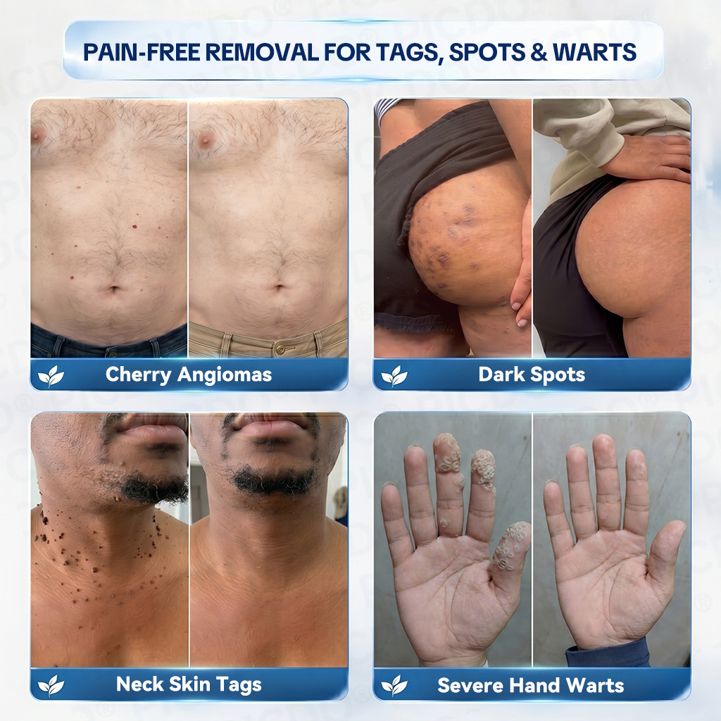 𝐏𝐡𝐚𝐫𝐦𝐚𝐜𝐢𝐬𝐭 𝐑𝐞𝐜𝐨𝐦𝐦𝐞𝐧𝐝𝐞𝐝 ✅𝐏𝐢𝐜𝐝𝐨® 𝐌𝐚𝐠𝐧𝐞𝐬𝐢𝐮𝐦 𝐑𝐞𝐩𝐚𝐢𝐫 𝐂𝐫𝐞𝐚𝐦🧴 (Zero Pain, Zero 𝐒𝐜𝐚𝐫𝐬 Formula) ⭐