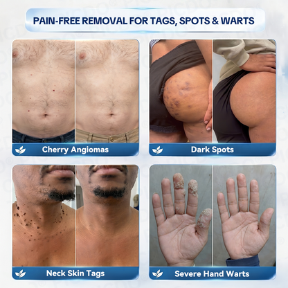 𝐏𝐡𝐚𝐫𝐦𝐚𝐜𝐢𝐬𝐭 𝐑𝐞𝐜𝐨𝐦𝐦𝐞𝐧𝐝𝐞𝐝 ✅𝐏𝐢𝐜𝐝𝐨® 𝐌𝐚𝐠𝐧𝐞𝐬𝐢𝐮𝐦 𝐑𝐞𝐩𝐚𝐢𝐫 𝐂𝐫𝐞𝐚𝐦🧴 (Zero Pain, Zero 𝐒𝐜𝐚𝐫𝐬 Formula) ⭐