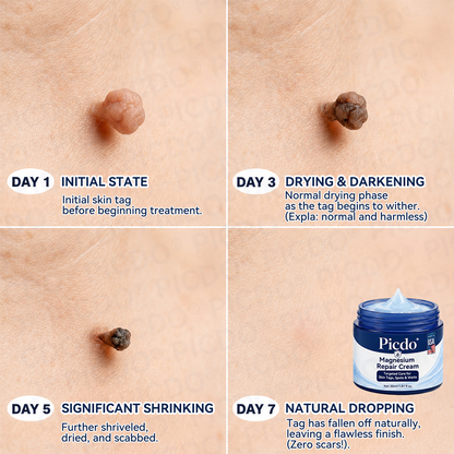 𝐏𝐡𝐚𝐫𝐦𝐚𝐜𝐢𝐬𝐭 𝐑𝐞𝐜𝐨𝐦𝐦𝐞𝐧𝐝𝐞𝐝 ✅𝐏𝐢𝐜𝐝𝐨® 𝐌𝐚𝐠𝐧𝐞𝐬𝐢𝐮𝐦 𝐑𝐞𝐩𝐚𝐢𝐫 𝐂𝐫𝐞𝐚𝐦🧴 (Zero Pain, Zero 𝐒𝐜𝐚𝐫𝐬 Formula) ⭐