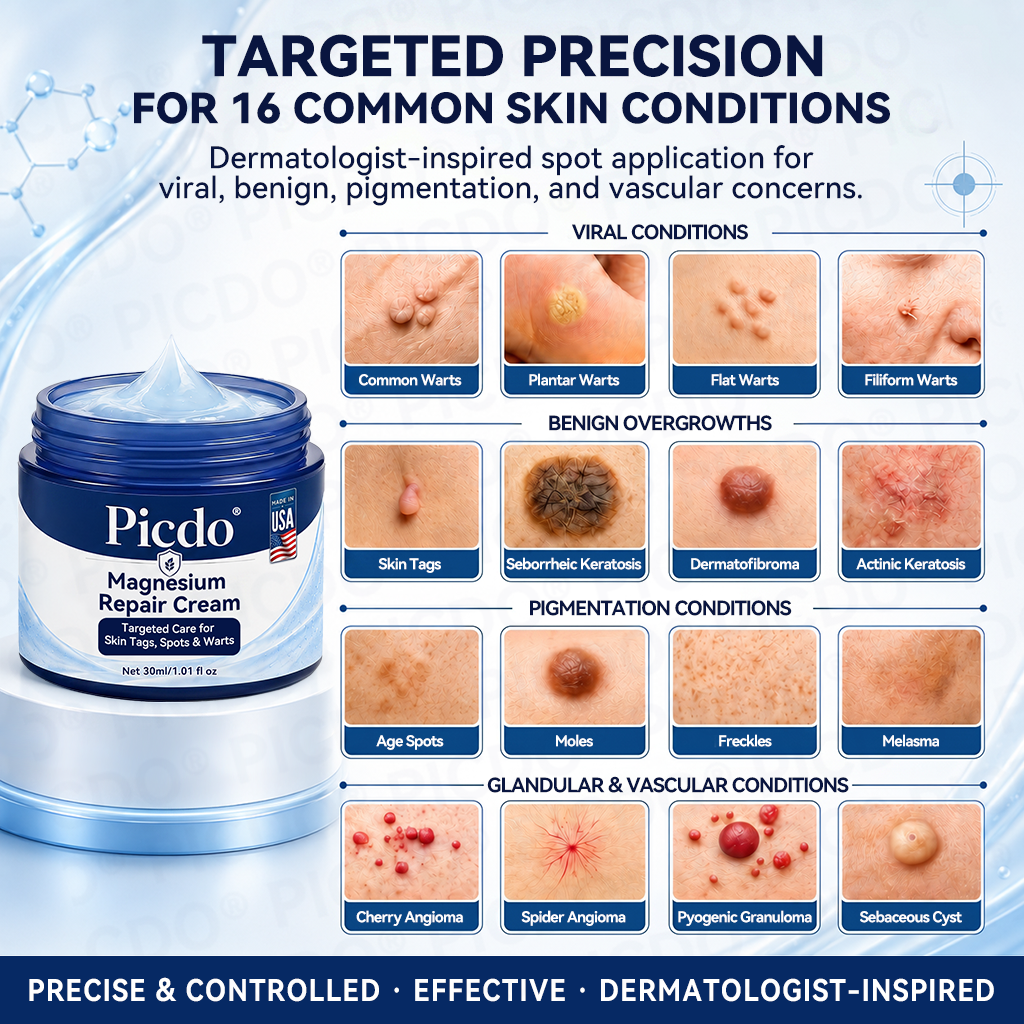 𝐏𝐡𝐚𝐫𝐦𝐚𝐜𝐢𝐬𝐭 𝐑𝐞𝐜𝐨𝐦𝐦𝐞𝐧𝐝𝐞𝐝 ✅𝐏𝐢𝐜𝐝𝐨® 𝐌𝐚𝐠𝐧𝐞𝐬𝐢𝐮𝐦 𝐑𝐞𝐩𝐚𝐢𝐫 𝐂𝐫𝐞𝐚𝐦🧴 (Zero Pain, Zero 𝐒𝐜𝐚𝐫𝐬 Formula) ⭐