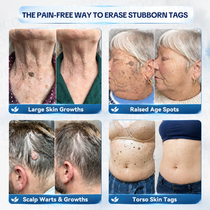 𝐏𝐡𝐚𝐫𝐦𝐚𝐜𝐢𝐬𝐭 𝐑𝐞𝐜𝐨𝐦𝐦𝐞𝐧𝐝𝐞𝐝 ✅𝐏𝐢𝐜𝐝𝐨® 7-𝐃𝐚𝐲 𝐒𝐤𝐢𝐧 𝐓𝐚𝐠 & 𝐒𝐩𝐨𝐭 𝐄𝐫𝐚𝐬𝐞𝐫 𝐂𝐫𝐞𝐚𝐦 🧴(Zero Pain, Zero 𝐒𝐜𝐚𝐫𝐬 Formula)💎