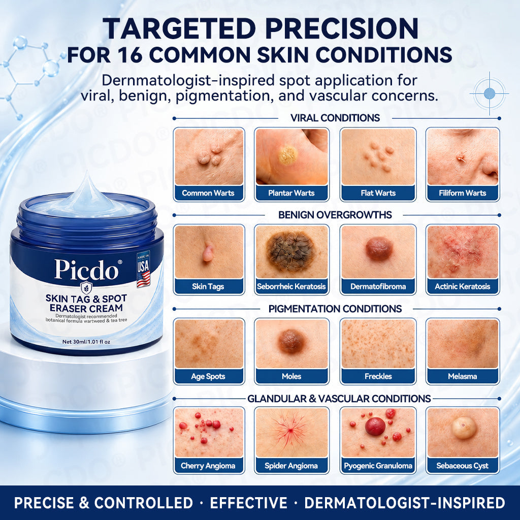 𝐏𝐡𝐚𝐫𝐦𝐚𝐜𝐢𝐬𝐭 𝐑𝐞𝐜𝐨𝐦𝐦𝐞𝐧𝐝𝐞𝐝 ✅𝐏𝐢𝐜𝐝𝐨® 7-𝐃𝐚𝐲 𝐒𝐤𝐢𝐧 𝐓𝐚𝐠 & 𝐒𝐩𝐨𝐭 𝐄𝐫𝐚𝐬𝐞𝐫 𝐂𝐫𝐞𝐚𝐦 🧴(Zero Pain, Zero 𝐒𝐜𝐚𝐫𝐬 Formula)💎