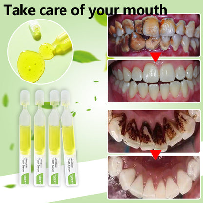 🔥TLOPA™ Ampoule Toothpaste(for all kinds of dental problems, including cosmetic and rejuvenation)