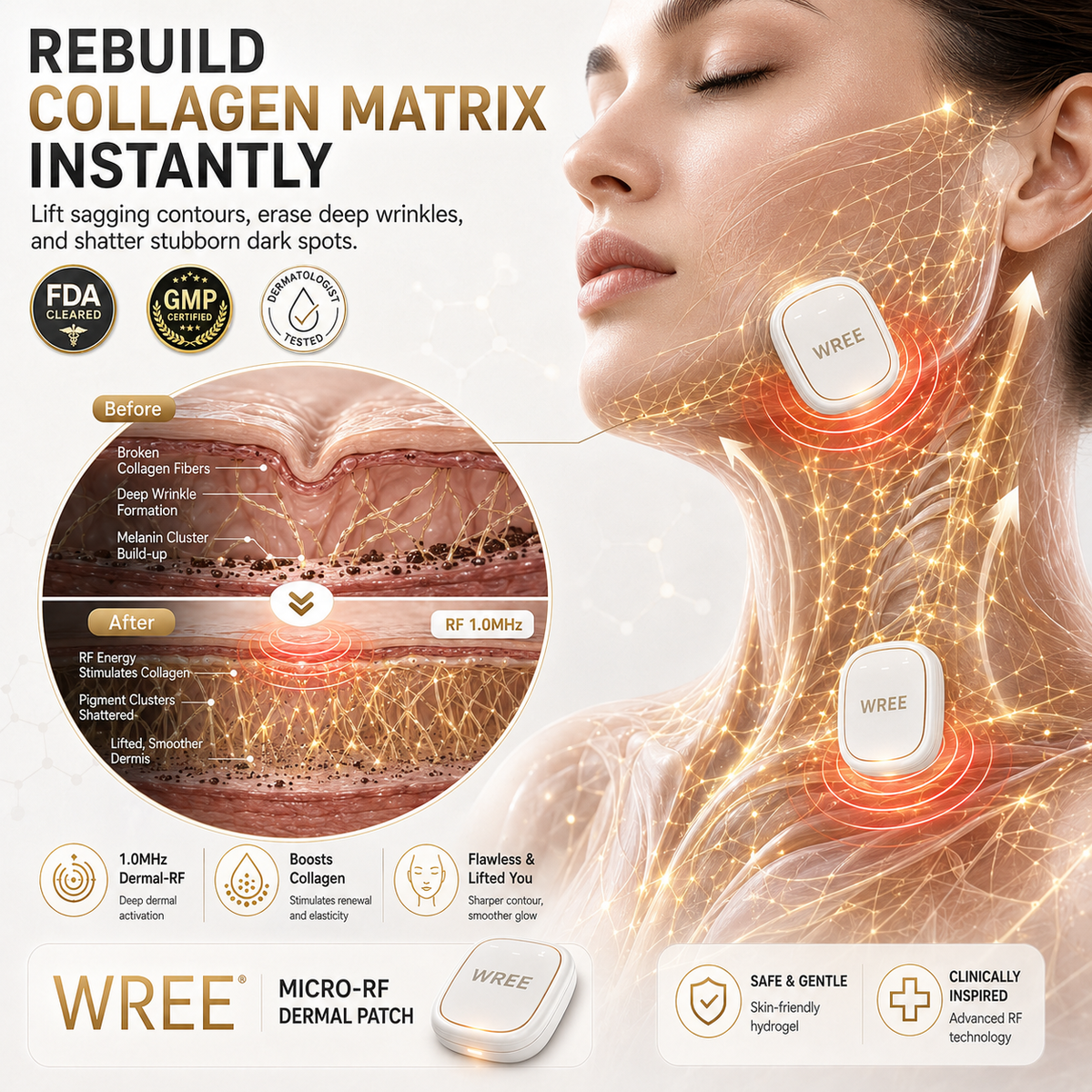 ⭐WREE® Anti-Wrinkle & Spot Removal Micro-RF Device
