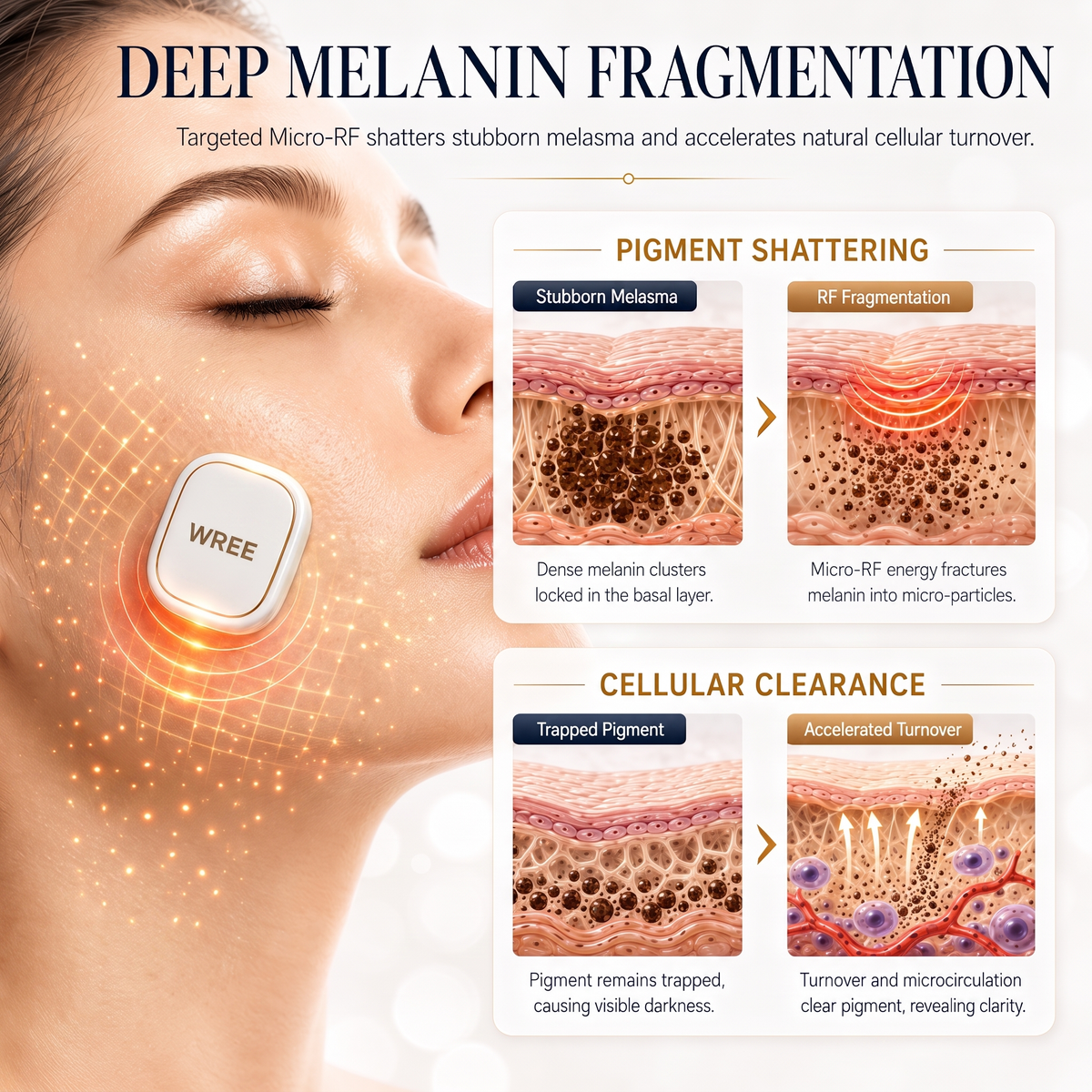 ⭐WREE® Anti-Wrinkle & Spot Removal Micro-RF Device